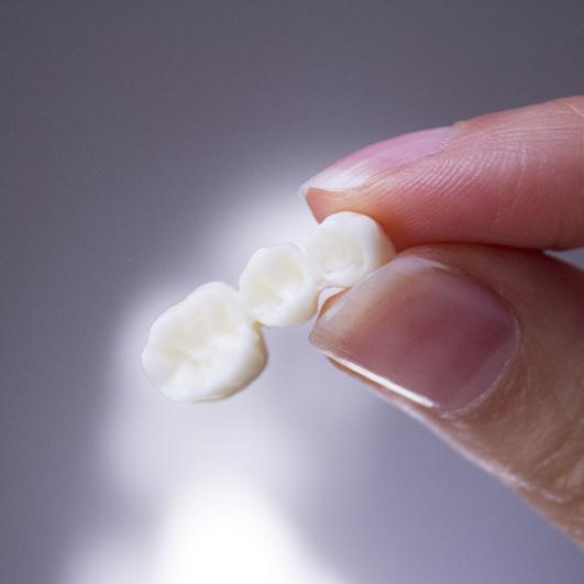 Hand holding a dental bridge